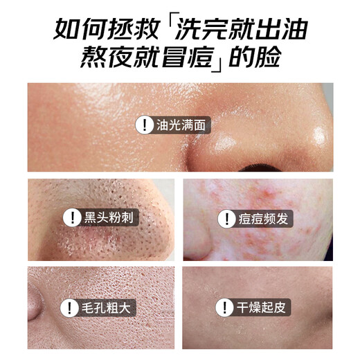 Ding Jiayi Cleanser Facial Men's Control de aceite de acné Exfoliación Blackhead Exfoliación Crema 150G Mujeres para el cuidado de la piel para hombres