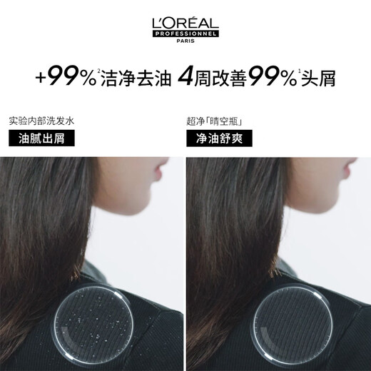 L'Oreal PRO [Xiao Zhan recommends] scalp specializing in anti-dandruff purification ultra-clean sky bottle shampoo 500ml