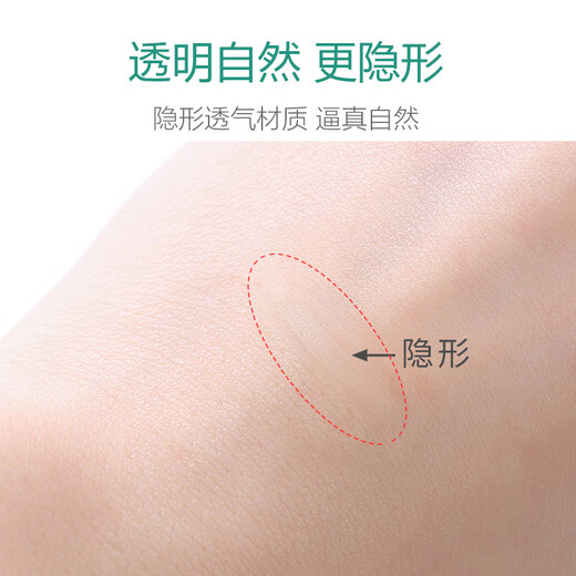 Jian Ying Shu 960 Transparent Invisible Meniscus Skin Color Double Eyelid Sticker Seamless Natural Lace Mesh Lightweight and Breathable