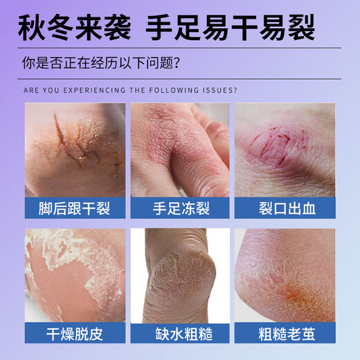 Shizhongtang Cracked Hand Cream 50g Vaseline Cracked Heels, Hands and Feet Cream Anti-Crack Official Crack Cream Chapped Cream