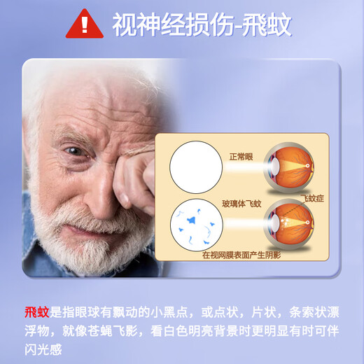 Original imported blueberry lutein ester in the United States for adults, children, middle-aged and elderly people, vitamin A, the official top ten rankings of floaters, macular dry vitreous turbidity, fuzzy eye protection lutein [only five bottles are required for price] 7 bottles of consolidation cycle suits for floaters, macular fatigue, dry astringent