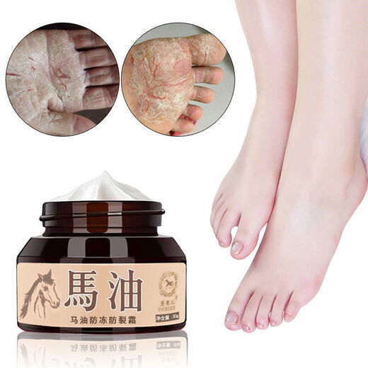 Daimeier Horse Oil for Cracked Hands and Feet, Dry and Peeling Hands and Feet, Cracked Feet, Cracked Heels, Anti-Cracking Cream, Protective Hand and Foot Cream 2 Bottles, Antifreeze + Anti-Drying + Repair + Moisturizing