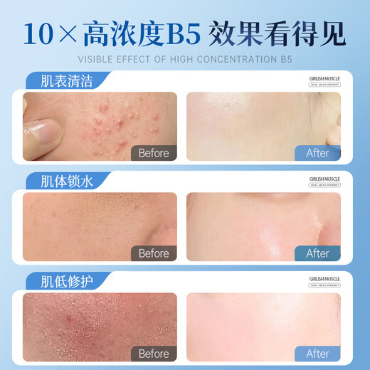 Ruyi (RUYI) B5 Men's Toner 500ml Moisturizing and Moisturizing Water Contract Pores and Removing Yellowness Stay Up and Skin Care Water