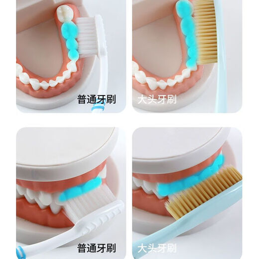 Xinyoujia Korean King's Brosse coréen Dr. White White étendu Big Head Brosse à dents King Brosse de dents 688 Grande Brush Head Hair Soft Nano Gold Brush Head Set 7 Hair 4