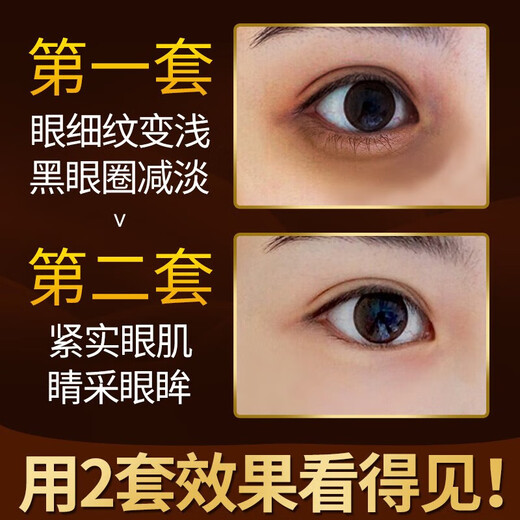 芳丹薄罗抗皱眼霜韩国进口原液淡化细纹提拉紧致黑眼圈眼袋男女熬夜 蜗牛抗皱日夜眼霜