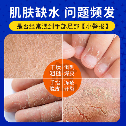 KOOGIS Japanese Ding Ding Cracked Cream Heel Anti-Dry Cracked Cracked Cracked Cracked Cracked Cracked Cracked Cracked Cracked Cracked Cracked Hands and Foot Moisturizer