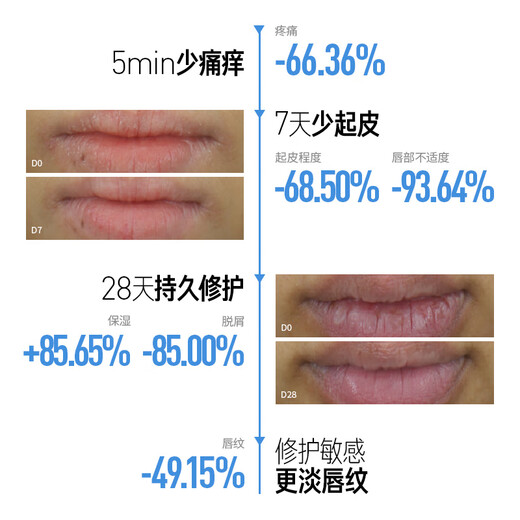 Lifetime MED Lip Balm 3g Moisturizing and Moisturizing Lip Balm Lip Cream Lip Essence for Men and Women Lip Essence