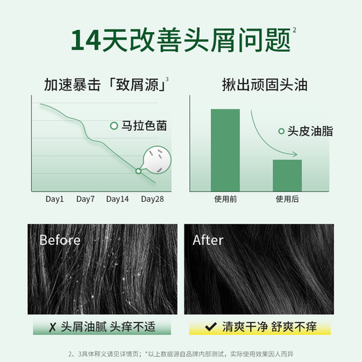 雨洁（RACLEN）洗发水舒缓止痒去屑洗发露500g持久清爽洗发液男士女士洗发膏