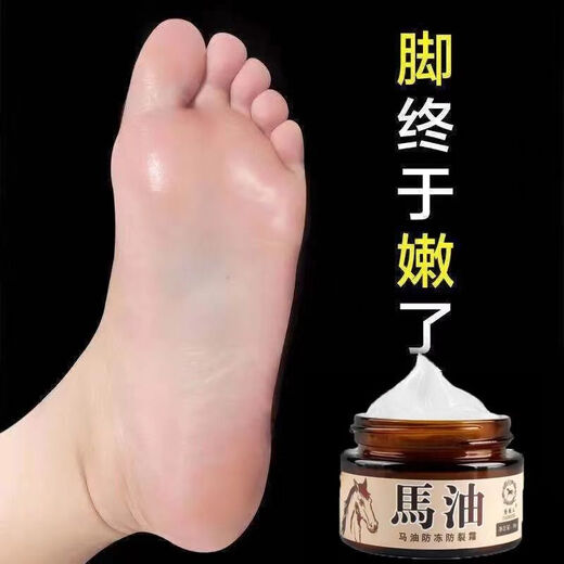 Daimeier Horse Oil for Cracked Hands and Feet, Dry and Peeling Hands and Feet, Cracked Feet, Cracked Heels, Anti-Cracking Cream, Protective Hand and Foot Cream 2 Bottles, Antifreeze + Anti-Drying + Repair + Moisturizing