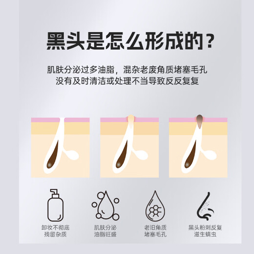 M arlincare visual ice hot compress blackhead extractor blackhead cleaning artifact cleaner blackhead suction instrument beauty instrument pearl white ice hot compress + visual