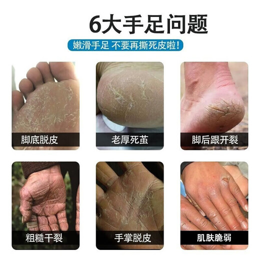 LONGRICH (LONGRICH) Snake Oil Hydrating Moisturizing Anti-Drying Skin Rejuvenation Hand Care Hand Mask Hand Cream 70g*2 Pcs + Tea Stain Cleanser