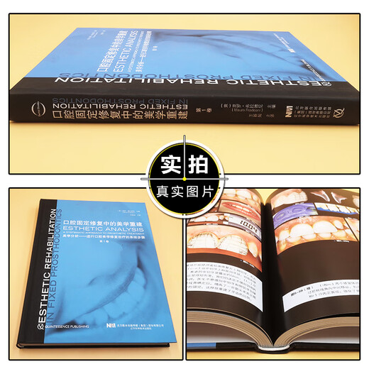 【自营优质】 口腔固定修复中的美学重建 第1卷 主译王新知 辽宁科学技术9787559116864 16864