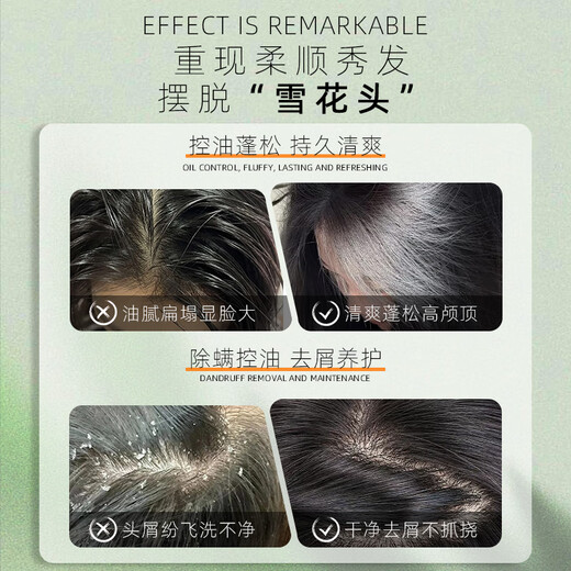 TiAsshu Caogu Jingyuan Champú enzimático Control Anti-Dandruff Aceite Refrescante y enjuague CAIEN