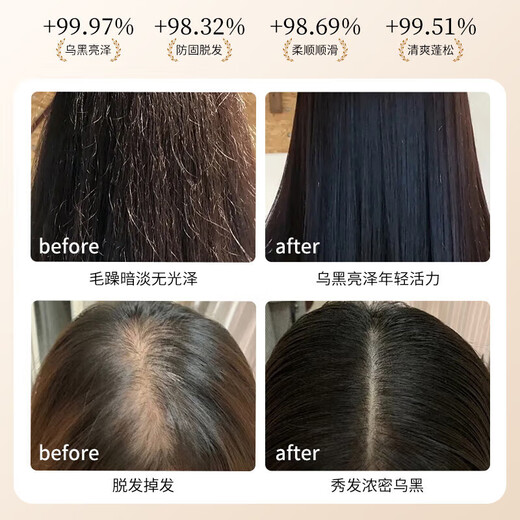 Dai Qingsi Anti-hair Loss and Growth Shampoo Official Hair Firming Lotion Anti-Breakage and Growth Hair Cream Flagship Oil Control and Anti-Dandruff Men's and Women's Store 2 bottles 840ml Anti-hair loss, firm and smooth hair