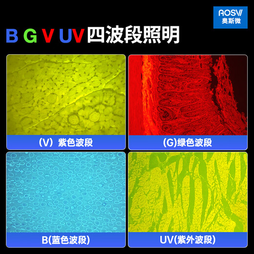 
AOSVI (AOSVI) fluorescent biomicroscope high-definition and high-power professional-grade scientific research and computer guide report cell pathology research L208F-3M830F (4-band + fluorescence camera)