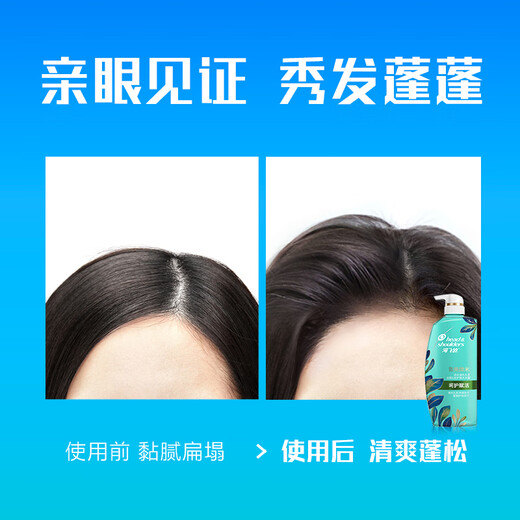 海飞丝去屑0硅油洗发水650ml呵护赋活男士女士洗头膏控油蓬松京东自营