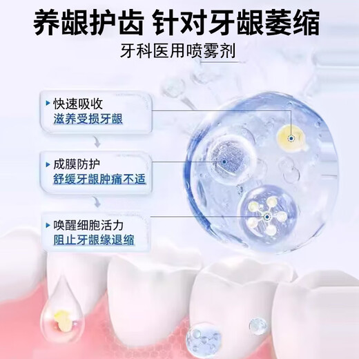 Special toothpaste for gingival atrophy toothpaste for loose teeth and tooth repair severe gingival atrophy repair regeneration spray GT [Strong combination] morning and evening match, spray one brush