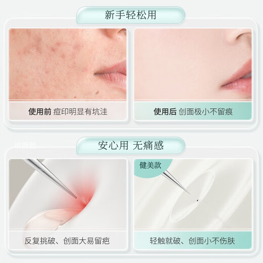 Jianmei Chuangyan Ultra-fine Acne Needle Set Cell Clip Blackhead Removal Tweezers Scraping Closed Mouth Squeezing Acne Removal Needle Cleaning Tool Ultra-sharp Cell Clip-Tip Nozzle 1 piece