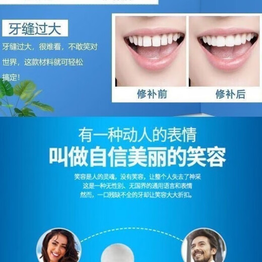 奇力康补牙齿神器材料自己在家补牙自粘补牙神器补牙材料临时补牙缝 967倍效【补15颗牙】爆丨款坚固不掉