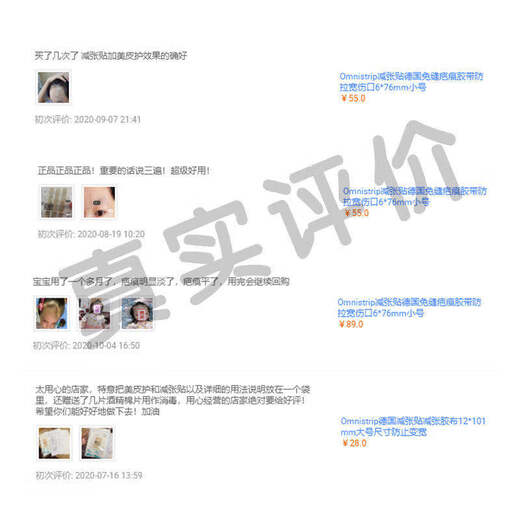 健康德免减张贴omnistrip免缝疤痕胶带防拉宽伤口小号大 超大号优惠组 12101mm3包18条中通