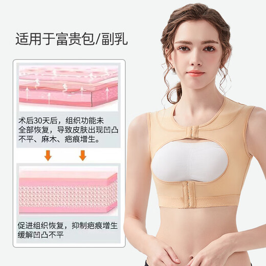 Aolan Shang Fugui bag of auxiliary breasts for the first phase of the special elastic body shaping suit without liposuction and liposuction. Back compression tights. Skin color L
