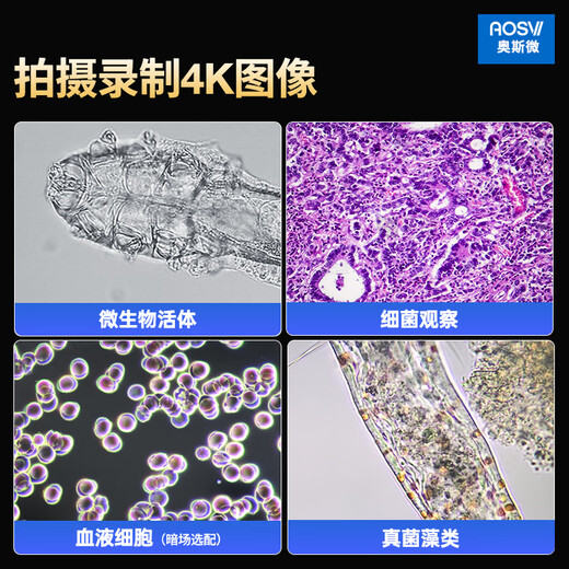 奥斯微（AOSVI）高清实验生物显微镜高倍观察细胞细菌精子螨虫4K专业生物显微镜 L608-AF830（自动对焦/4K拍录含4K屏）
