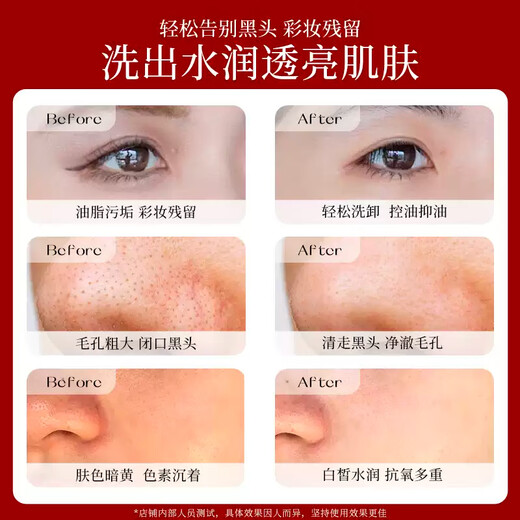 SHISEIDO Facial Cleanser Mild Red Kidney Moisturizing Facial Cleanser Revitalizing Facial Cleanser 125ml (moisturizing type)