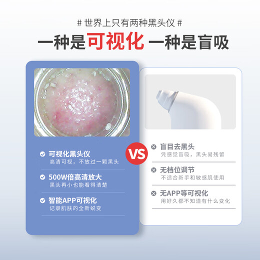 M arlincare visual ice hot compress blackhead extractor blackhead cleaning artifact cleaner blackhead suction instrument beauty instrument pearl white ice hot compress + visual