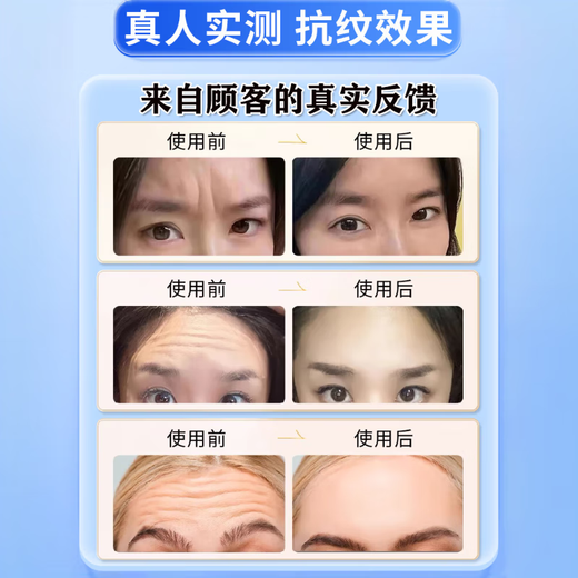 Simuchuan character pattern removal tool fills head-up pattern to remove severe wrinkles and nasolabial folds and sleeping paste paste for men and women, lifelong resurgence [5 boxes] Buy three and get two free
