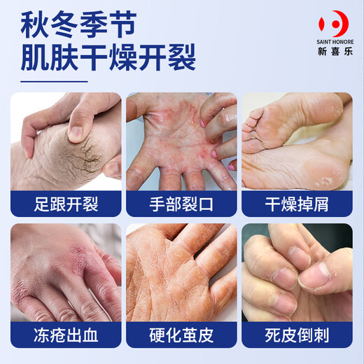 Xinxile cracking 85g Vaseline hand cream to prevent dry cracking of hands, feet and heels, non-medical genuine anti-cracking cream