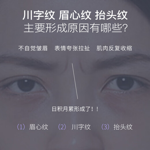CandyMoyo Sichuan pattern invisible patch, anti-frowning and forehead wrinkle patch, magic tool to improve and fade wrinkles, nasolabial folds, firming and firming