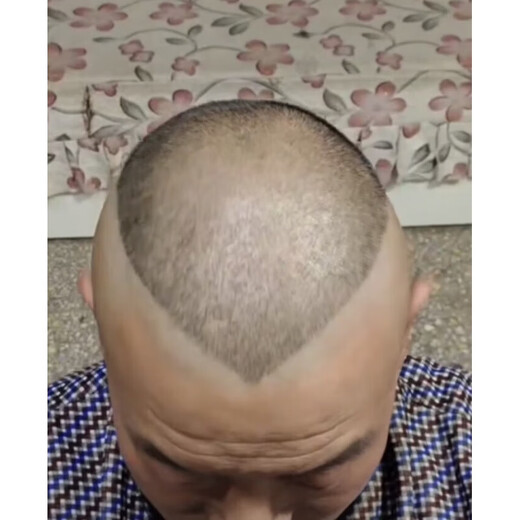 Jin Jinyangs eigenes Haarschnitt Haarschimmel Guo Degangs Erwachsener Frisur Guo Degangs Pfirsich Herz Kurzhaar -Rasierassistent Guo Degang 1416 cm