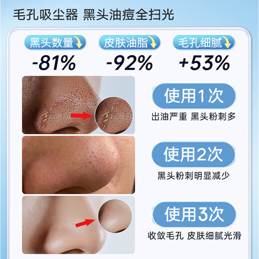 Pengjing blackhead suction instrument, blackhead cleaning artifact, facial small bubble cleaning instrument, acne pore deep blackhead removal beauty instrument for men and women, gift for girlfriend, rechargeable vacuum negative pressure, suck out blackheads