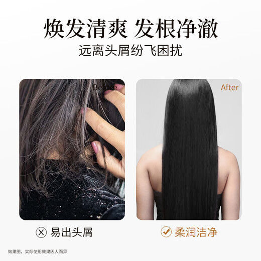 Lafang Shampoo Hidratando el champú antidandico 750 ml de crema de lavado nutricional universal para hombres y mujeres