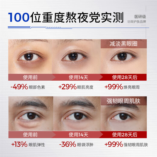 SUMDOY Japanese imported eye cream removes dark circles and eye bags, lightens fine lines, lifts and tightens men and women's stay up late artifact [Eye cream *2 Eye mask *2] Eye cream *2 Eye mask *2
