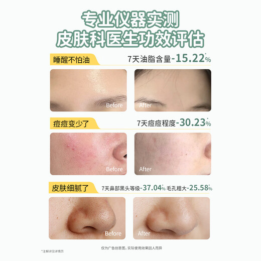 Kangaroo Mom Youth Facial Cleanser, Oil Control, Acne Removal, Cleansing and Skin Care for Adolescent Male and Female Students, Children's Facial Cleanser 100g*2