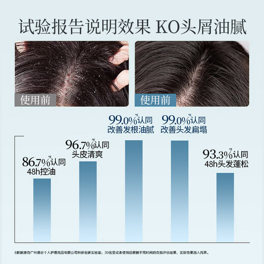 Adolf Shampoo ätherisches Ölduft Shampoo Anti-Dandruff-Kontrollöl erfrischend und spülen lang anhaltende Aroma universell für Männer und Frauen Ölkontrolle erfrischend Shampoo 420 ml+80 ml