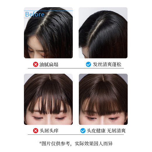 Kao (KAO) wakes up without getting messy Essential imported refreshing anti-gloss shampoo 700ml fluffy oil-controlled and itchy-relieving anti-dandruff