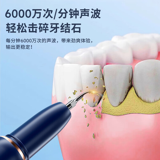 Sawang Germany Tooth Cleaner Household Calculus Remover Removes Smoke Stains and Yellowing Cleans Teeth Smoke Stains Tea Stains Tartar Calculus Scaler Dental Care Tool Silver White 3000W High Frequency Teeth Cleaning Protects Teeth and Gums