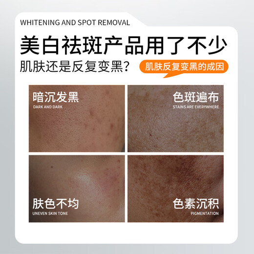 
Shuimengling Facial Cream Whitening, Anti-freckle, Hydrating and Brightening White and Glossy Anti-freckle Cream Official Store Genuine 60g*1 Bottle [Improve dullness, moisturize and brighten]