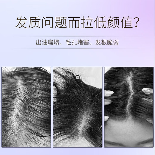 欧莱雅玻尿酸水光盈润洗发水紫安瓶控油蓬松丰盈改善毛躁柔顺护理洗发露 洗护套装880ml+洗护小样200ml