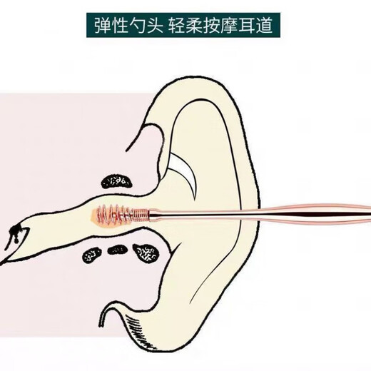 MPPMCK新款掏耳屎神器挖耳勺挖耳屎神器螺旋两用一体弹簧掏耳勺耳12189 玫瑰金+太空银【组合装】