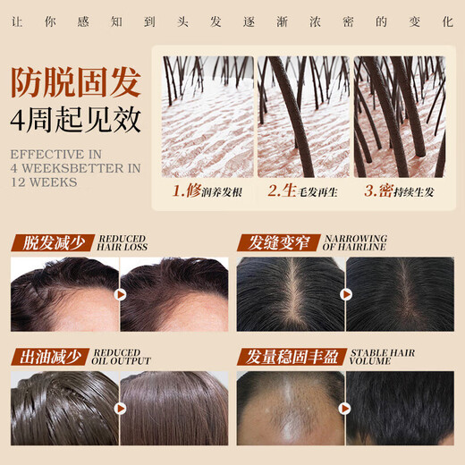Dai Qingsi Anti-hair Loss and Growth Shampoo Official Hair Firming Lotion Anti-Breakage and Growth Hair Cream Flagship Oil Control and Anti-Dandruff Men's and Women's Store 2 bottles 840ml Anti-hair loss, firm and smooth hair