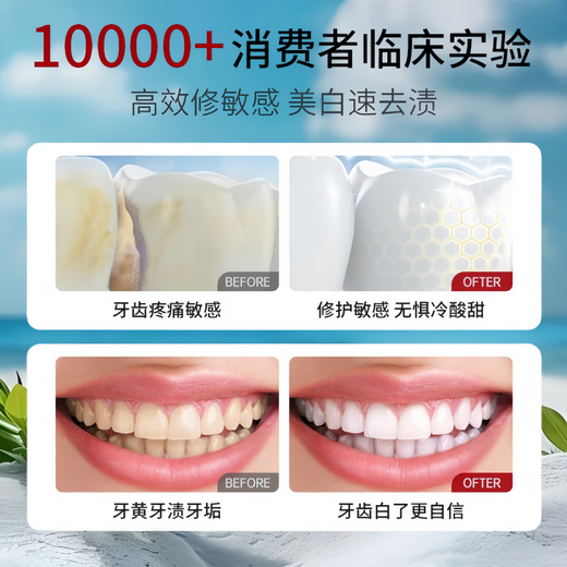 Wishine泰国进口美白牙膏口臭去黄去牙渍去烟渍牙垢清新口气亮白牙齿150g
