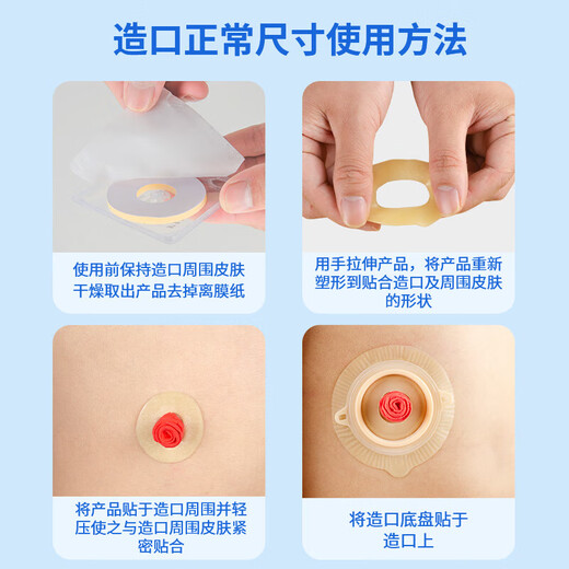 Nurse classmate stoma leakage protection ring 12035 same plastic patch ring chassis leakage protection seal elastic glue stoma care products 12030 [10 pieces/box] 2mm stoma leakage protection ring