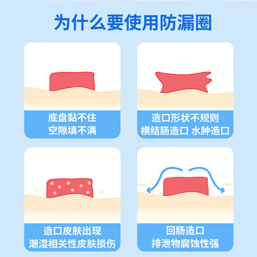 Nurse classmate stoma leakage protection ring 12035 same plastic patch ring chassis leakage protection seal elastic glue stoma care products 12030 [10 pieces/box] 2mm stoma leakage protection ring