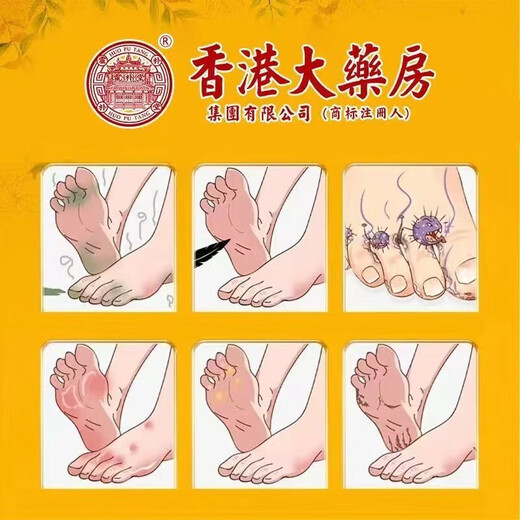 Hong Kong Pharmacy Biphenyl Antibacterial Spray Original Old Packaging Benzyl Spray Solution 60ml Spray Upgraded New Packaging Antibacterial 1 Box Trial Pack 60ml/box