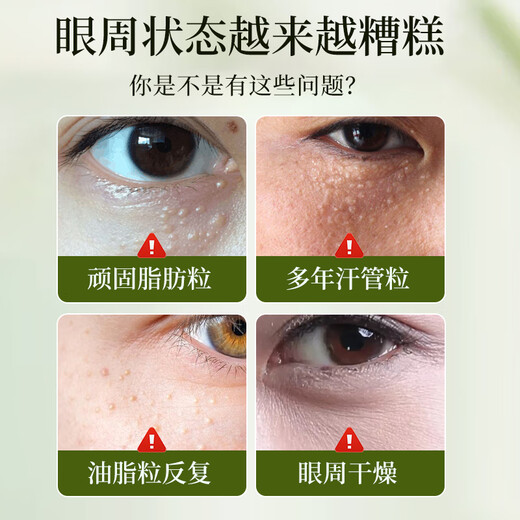 珂大生物脂肪粒眼部精华液颗粒清肌油脂粒黑眼圈眼袋眼补水保湿嫩肤凝胶霜 两盒装