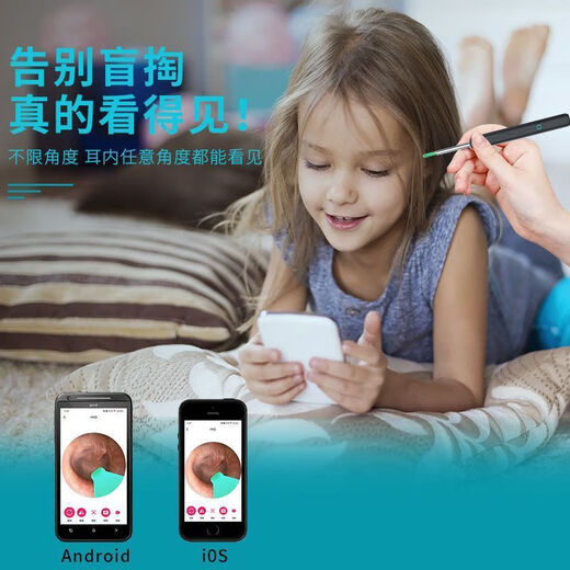 Spoon de oreja de visión Xiaomi Nuevo endoscopio de orejas visuales inalámbricas inalámbricas endoscopio ultra definición Niños y ancianos Cleaning de seguridad marfil White White AAA [2.3 mil millones de usuarios-Cava mientras mira] Modelo de lujo de mejor ajuste [9900W Ultra-definición] Universal para niños y adultos y adultos