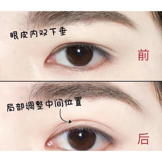 Magic Beauty Lace Double Eyelid Sticker, invisible and traceless, sticks to water and glue-free, special lace hollow for inner double eyelids to prevent eye corner sagging, 624 stickers, lace size M (13 photos)